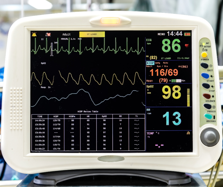 How Much Does An EKG Really Cost AHC